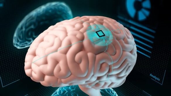 Miles se Postulan para Implantes Cerebrales de Neuralink – RevuTJ
